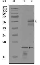 IHC-plus™ Monoclonal Mouse anti-Human ERBB3 / HER3 Antibody (clone 3F10F6, IHC, WB)