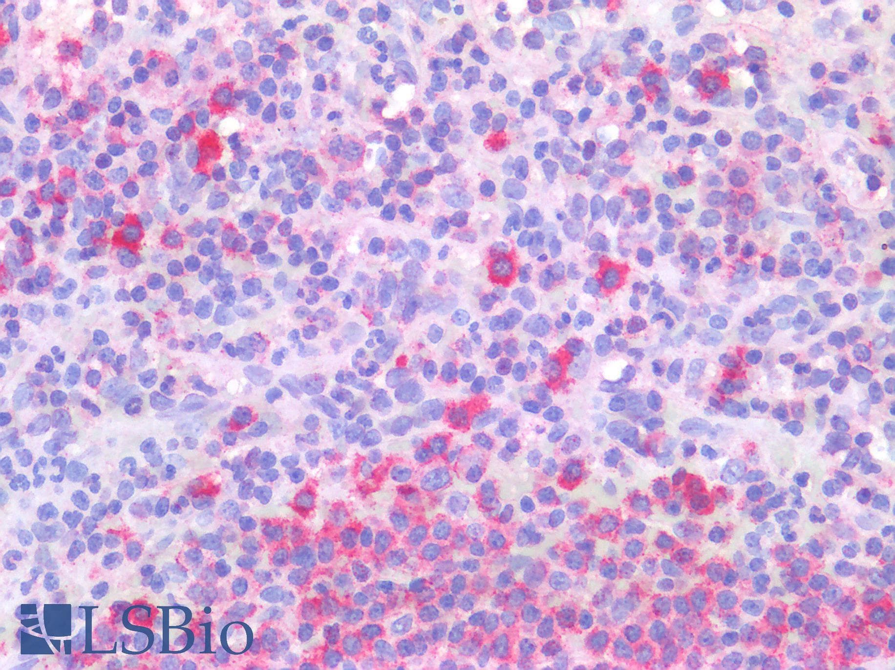 PathPlus™ ABCA7 Antibody