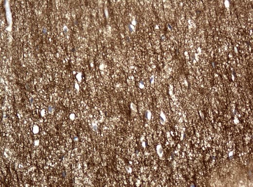 L1CAM Antibody (clone UMAB47, Carrier-free)