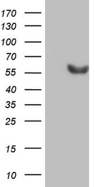 ESRRB / ERR Beta Antibody (aa1-252, clone OTI2D7)