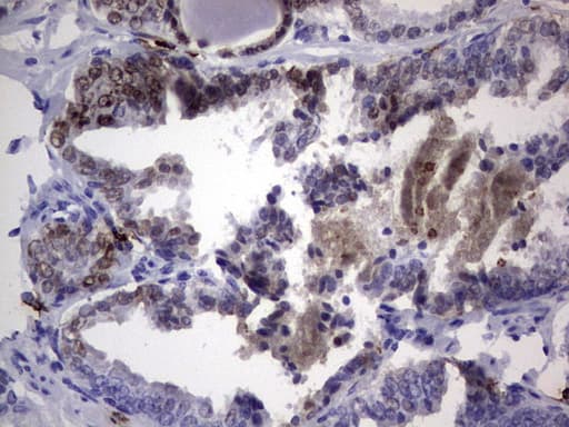 NKX3-1 Antibody (clone OTI1C2)