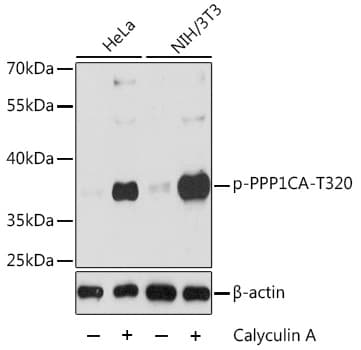 Polyclonal Rabbit anti-Human PPP1CA / PP1-Alpha Antibody (phospho-Thr320, WB)