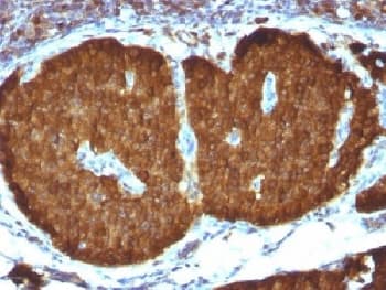 ENO2 / NSE Antibody (clone ENO2/1375)