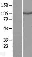 DRC7 / CCDC135 Protein (Over-Expression Lysate Myc-DDK (Flag))