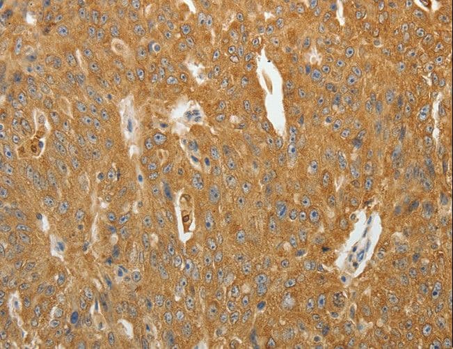 Polyclonal Rabbit anti-Human AKR1B1 / Aldose Reductase Antibody (IHC, WB)