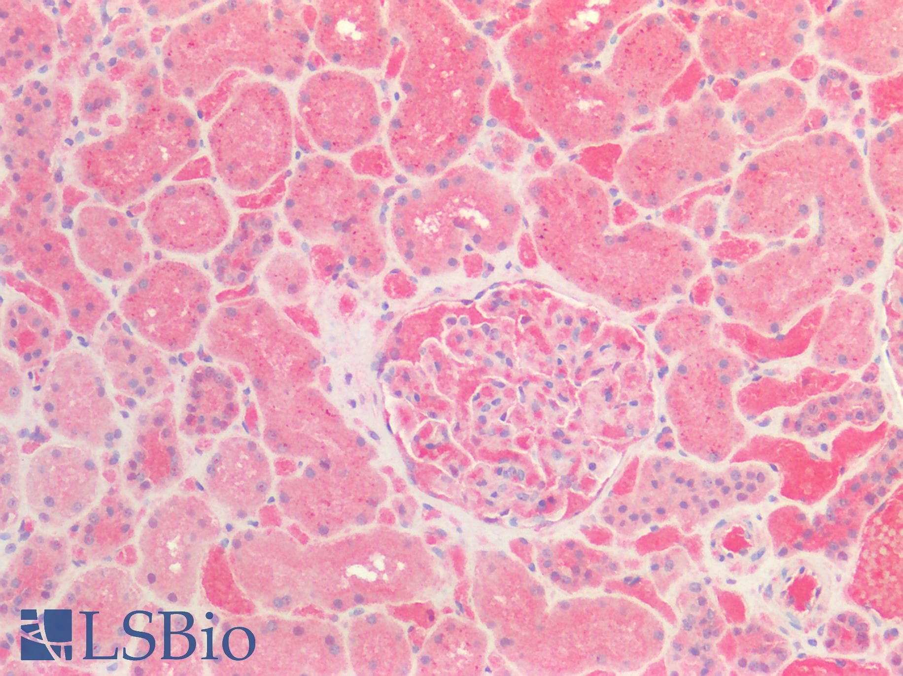IHC-plus™ TTR / Transthyretin Antibody