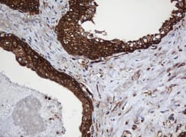 PAI-RBP1 / SERBP1 Antibody (aa1-262, clone OTI2C11)