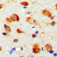 MYO1D Antibody (C-Terminus)