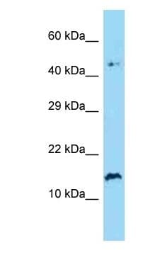 Polyclonal Rabbit anti-Human SPRR2A Antibody (C-Terminus, WB)