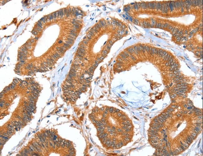 ACOT11 / THEA Antibody