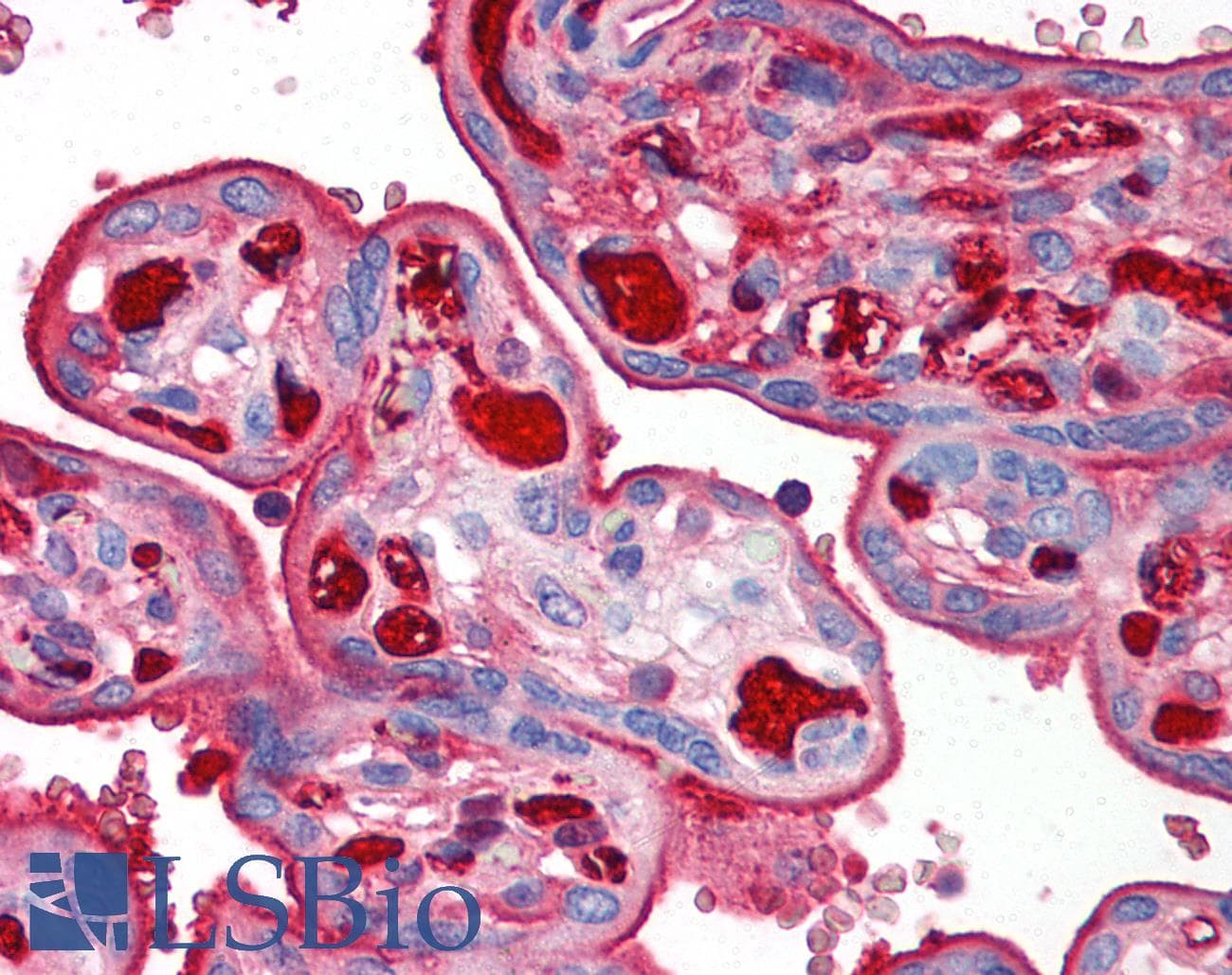 IHC-plus™ TNFRSF12A / TWEAK Receptor Antibody