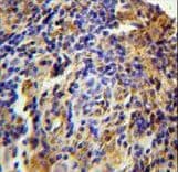 Polyclonal Rabbit anti-Human C11orf73 Antibody (aa6-35, IHC, WB)