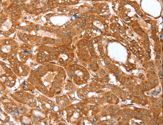 Polyclonal Rabbit anti-Human CNN3 Antibody (IHC, WB)