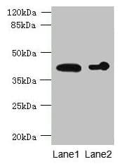 ASPHD2 Antibody