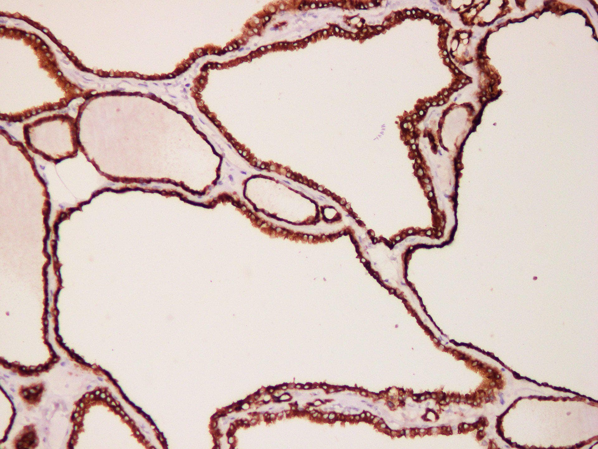 TPO / Thyroid Peroxidase Antibody