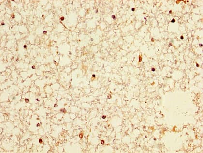 Polyclonal Rabbit anti-Human NXF / NPAS4 Antibody (IHC, WB)