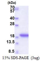 Human MRFAP1L1 Protein (Recombinant His)