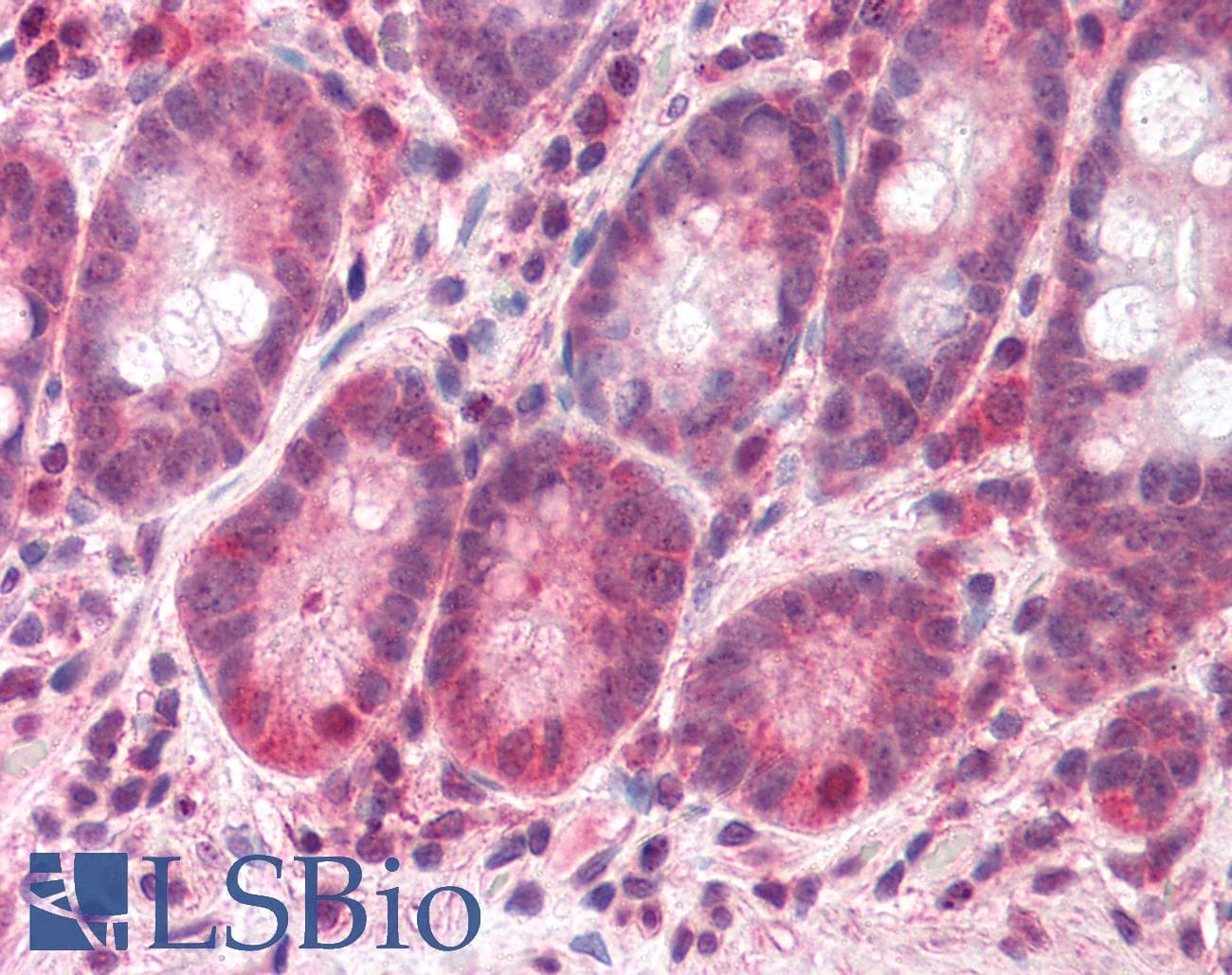 IHC-plus™ BAZ2B Antibody (aa2156-2168)