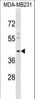 Polyclonal Rabbit anti-Human KCNJ15 / KIR4.2 Antibody (aa339-367, WB)