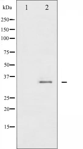 CDK1 / CDC2 Antibody (phospho-Tyr15)