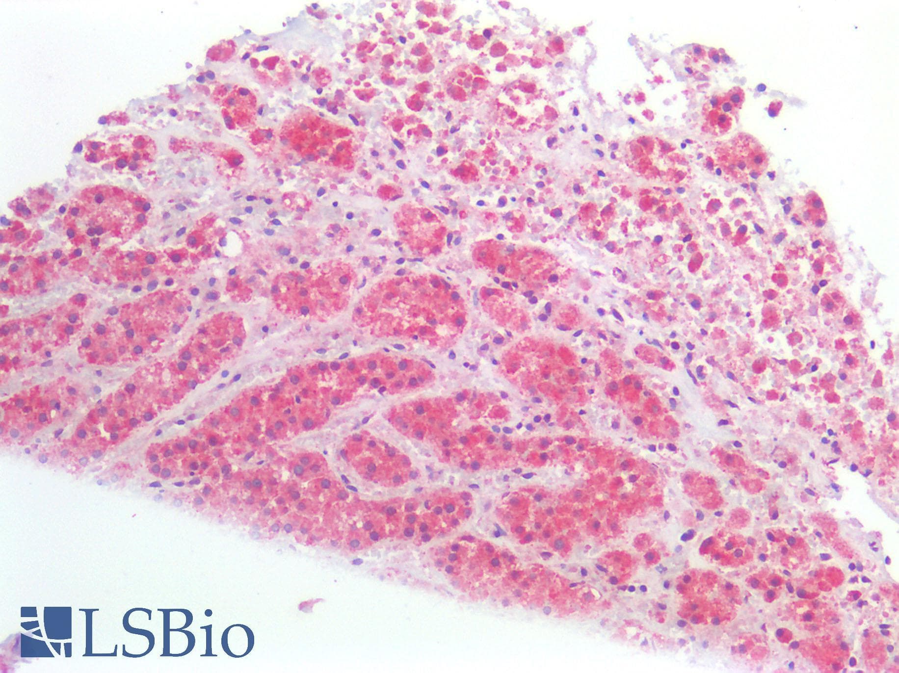 TREM2 / TREM-2 Antibody