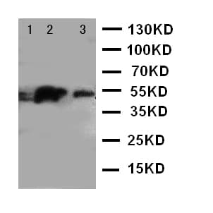 IRAK4 / IRAK-4 Antibody (aa45-59)