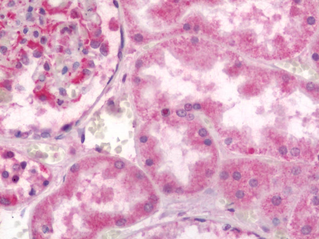 IHC-plus™ Polyclonal Rabbit anti-Human NDST2 Antibody (IHC, IF, WB)