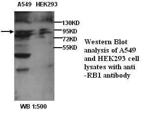 Polyclonal Rabbit anti-Human RB1 / Retinoblastoma / RB Antibody (IHC, WB)