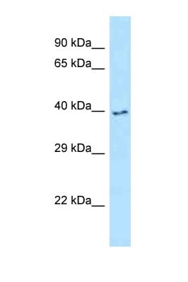 IRAK4 / IRAK-4 Antibody (aa258-307)