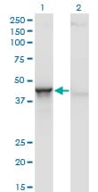 IHC-plus™ ACY1 / Aminoacylase 1 Antibody (clone 4F1-B7)