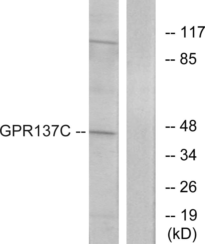 IHC-plus™ GPR137C / TM7SF1L2 Antibody (aa256-305)