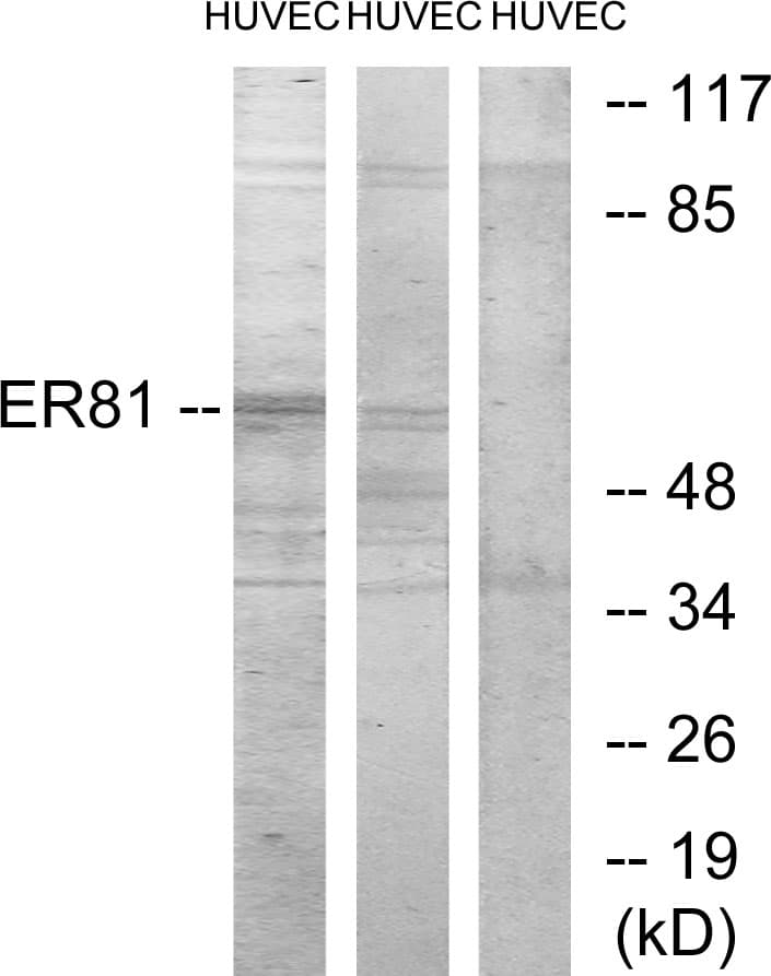 Polyclonal Rabbit anti-Human ER81 / ETV1 Antibody (aa10-59, WB)