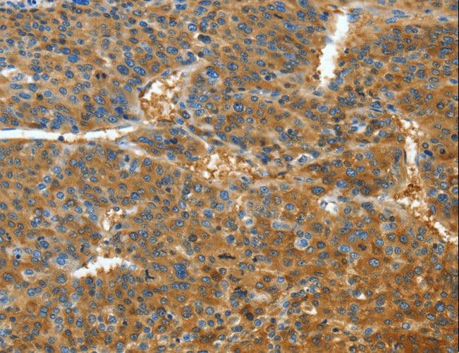 BAFF / TNFSF13B Antibody