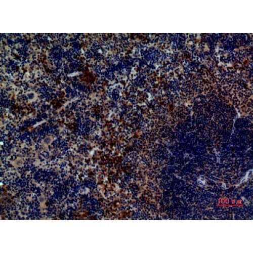 Polyclonal Rabbit anti-Human PAX5 Antibody (161-210 aa, Internal, IHC, WB)