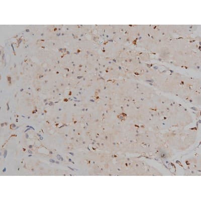 MAPT / Tau Antibody (phospho-Ser404)