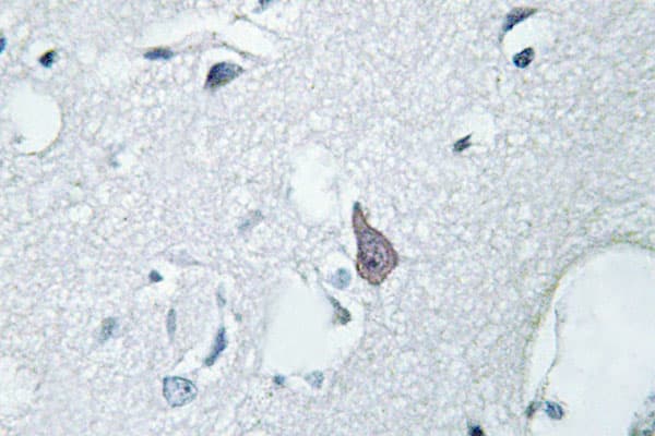 OPRM1 / Mu Opioid Receptor Antibody (Ser57)