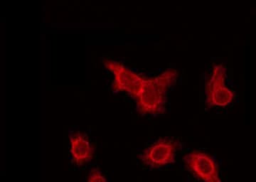 Polyclonal Rabbit anti-Human CYP2A6 Antibody (IHC, IF, WB)