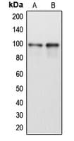 DP97 / DDX54 Antibody (Internal)