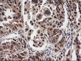 NUDT18 Antibody (clone OTI5F9)