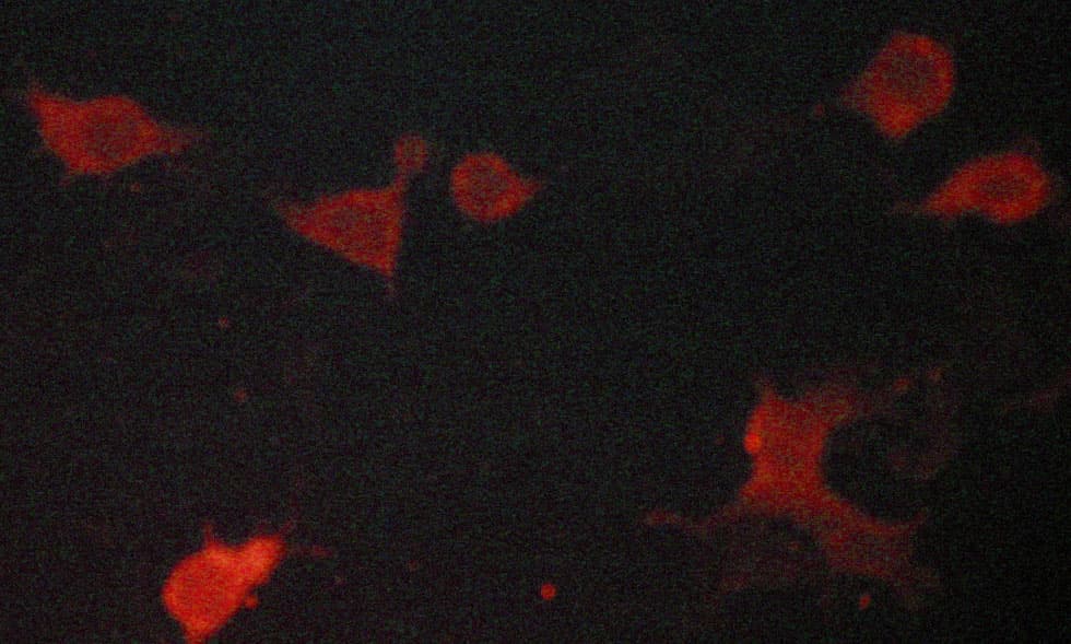 ACTN2 Antibody