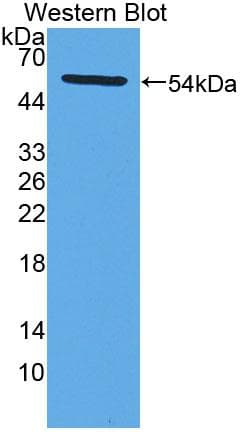 LPCAT1 / AYTL2 Antibody (aa301-514)