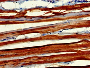 MYBPC2 Antibody