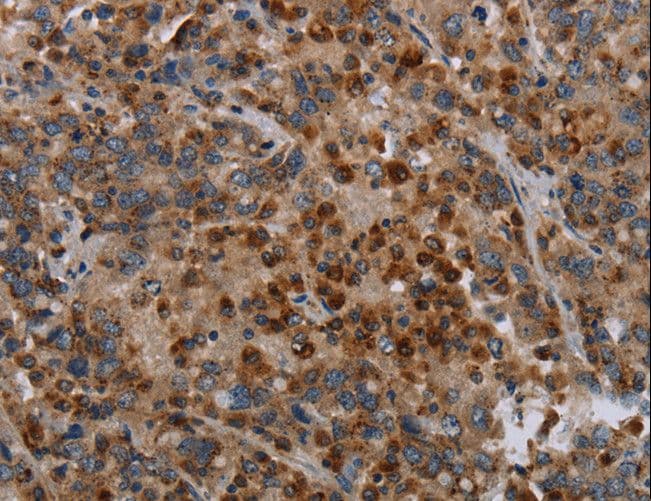 Polyclonal Rabbit anti-Human MAP3K11 / MLK3 Antibody (IHC, WB)