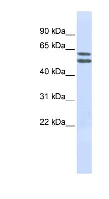 Polyclonal Rabbit anti-Human PIGQ Antibody (aa144-193, WB)
