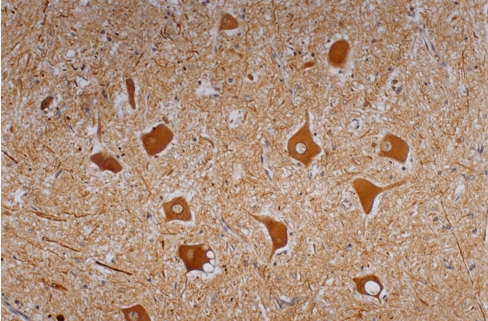 NEFH / NF-H Antibody (clone NF-01)