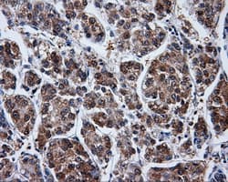 PME-1 / PPME1 Antibody (clone OTI4A12)