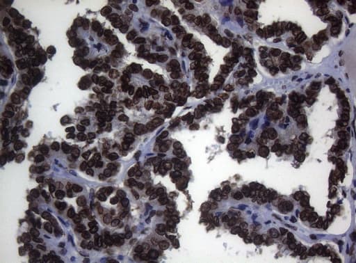BCL6 Antibody (aa1-300, clone OTI1C3, Carrier-free)