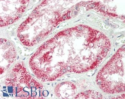 IHC-plus™ Dystonin / BPAG1 Antibody