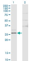 CTRB1 / Chymotrypsinogen B1 Antibody (clone 3C8)