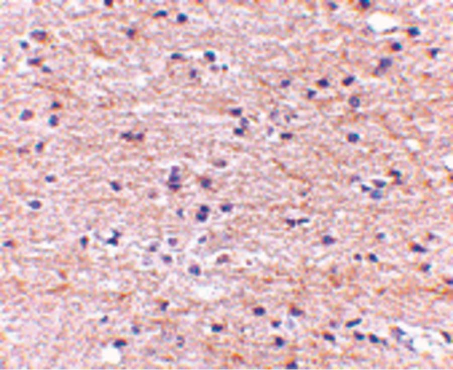 SATB2 Antibody
